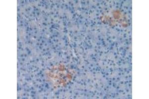 Detection of SP in Human Pancreas Tissue using Polyclonal Antibody to Substance P (SP) (Substance P antibody)