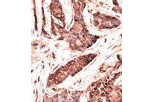 Image no. 2 for anti-2'-5'-Oligoadenylate Synthetase-Like (OASL) (C-Term) antibody (ABIN358720) (OASL antibody  (C-Term))