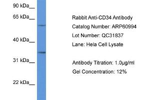Western Blotting (WB) image for anti-CD34 (CD34) (C-Term) antibody (ABIN2788647) (CD34 antibody  (C-Term))