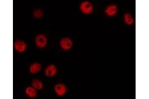 ABIN6266480 staining HeLa by IF/ICC. (Cyclin H antibody  (C-Term))