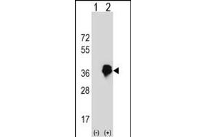 MLX antibody  (AA 125-151)