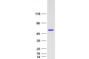 Western Blotting (WB) image for Death-Associated Protein Kinase 3 (DAPK3) protein (Myc-DYKDDDDK Tag) (ABIN2719223)