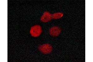 Immunofluorescence (fixed cells) (IF/ICC) image for anti-Mediator Complex Subunit 1 (MED1) (pThr1457) antibody (ABIN6256479)
