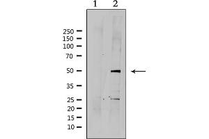Western blot analysis of extracts from HepG2, using SUV39H2 Antibody. (SUV39H2 antibody  (Internal Region))