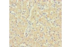 Immunohistochemistry of paraffin-embedded human liver tissue using ABIN7156211 at dilution of 1:100 (IDO2 antibody  (AA 1-407))