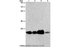 Western blot analysis of 293T cell and human fetal liver tissue, human cervical cancer and fetal muscle tissue, using ARFRP1 Polyclonal Antibody at dilution of 1:800
