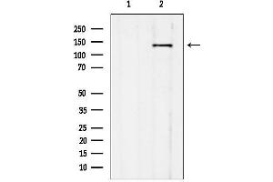 anti-ATP/GTP Binding Protein 1 (AGTPBP1) (Internal Region) antibody