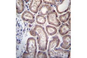 Formalin fixed, paraffin embedded human kidney tissue stained with SP140 Antibody   followed by peroxidase conjugation of the secondary antibody and DAB staining. (SP140 antibody  (Middle Region))