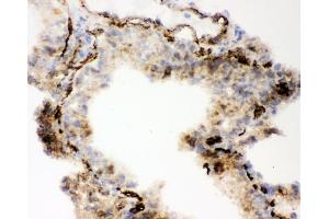 IHC analysis of ACE using anti-ACE antibody (ABIN3043777). (Angiotensin I Converting Enzyme 1 antibody  (AA 651-864))