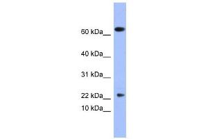 PLA2G5 antibody used at 1 ug/ml to detect target protein.