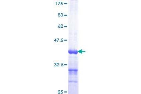 HRAS Protein (AA 80-179) (GST tag)