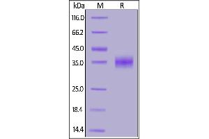 SDS-PAGE (SDS) image for SARS-Coronavirus Spike Protein (SARS-CoV S) (RBD) protein (His tag) (ABIN6952627)