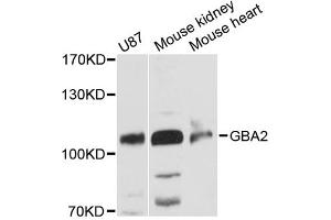 Western blot analysis of extracts of various cell lines, using GBA2 antibody (ABIN6292695) at 1:3000 dilution. (GBA2 antibody)