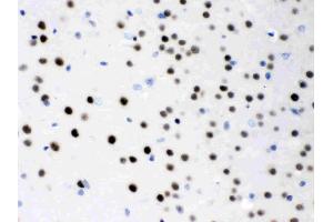 Immunohistochemistry (IHC) image for anti-Myocyte Enhancer Factor 2A (MEF2A) (AA 466-507), (C-Term) antibody (ABIN4886665)
