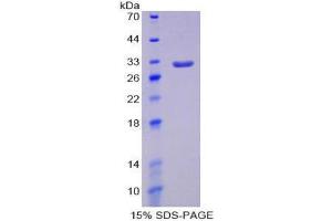 SDS-PAGE (SDS) image for Signal-Regulatory Protein alpha (SIRPA) (AA 56-296) protein (His tag) (ABIN2126751)