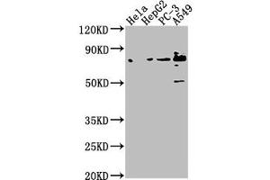 Western Blot Positive WB detected in: Hela whole cell lysate, HepG2 whole cell lysate, PC-3 whole cell lysate, A549 whole cell lysate All lanes: TNS4 antibody at 1:1000 Secondary Goat polyclonal to rabbit IgG at 1/50000 dilution Predicted band size: 77 kDa Observed band size: 77 kDa (Tensin 4 antibody  (AA 20-231))