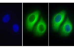 Detection of TUBb in Human Hela cell using Polyclonal Antibody to Tubulin Beta (TUBb) (TUBB antibody  (AA 170-419))