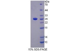 SDS-PAGE analysis of Human LRP3 Protein.