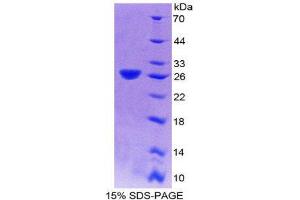 SDS-PAGE (SDS) image for Dynamin 2 (DNM2) (AA 533-731) protein (His tag) (ABIN2124674)