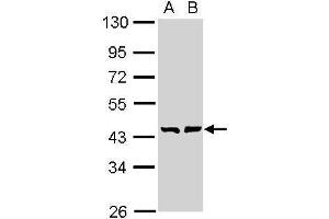WB Image Sample (30 ug of whole cell lysate) A: A431 , B: H1299 10% SDS PAGE antibody diluted at 1:1000 (GMDS antibody)