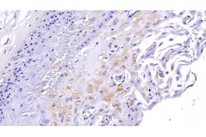 Immunohistochemistry (IHC) image for anti-PDZ and LIM Domain 1 (PDLIM1) (AA 2-329) antibody (ABIN7441679)
