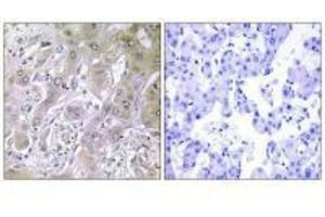 ACOT12 antibody