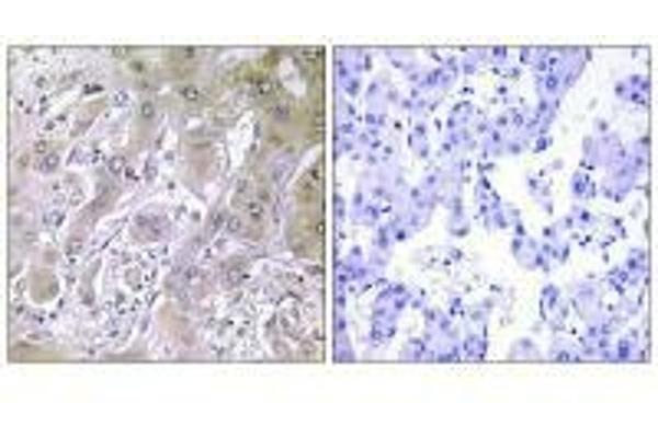 ACOT12 antibody