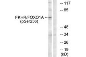 Western blot analysis of extracts from HeLa cells treated with EGF+Serum, using FKHR (Phospho-Ser256) Antibody. (FOXO1 antibody  (pSer256))
