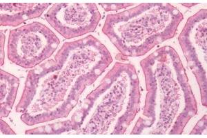 Human Small Intestine: Formalin-Fixed, Paraffin-Embedded (FFPE) (F2RL1 antibody  (C-Term))