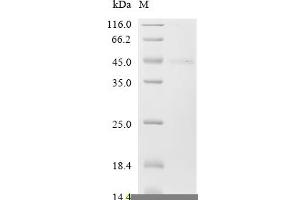 Fibronectin 1 (FN1) (AA 33-404) protein (His tag)