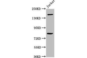 Western Blot Positive WB detected in: Jurkat whole cell lysate All lanes: BCL9 antibody at 3. (BCL9 antibody  (AA 231-340))