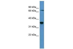 Western Blot showing SH3BP5 antibody used at a concentration of 1-2 ug/ml to detect its target protein. (SH3BP5 antibody  (C-Term))