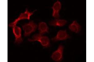 ABIN6266773 staining HeLa by IF/ICC.