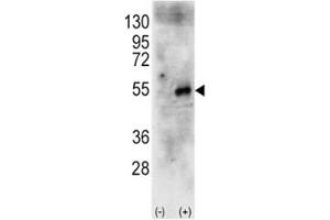 Western Blotting (WB) image for anti-Ribosomal Protein S6 Kinase, 70kDa, Polypeptide 2 (RPS6KB2) (AA 243-272) antibody (ABIN3028985)