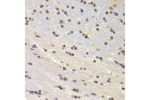 Immunohistochemistry of paraffin-embedded rat brain using PRPF3 Antibody.