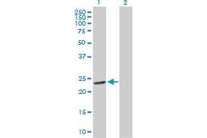 Western Blot analysis of GSTM4 expression in transfected 293T cell line by GSTM4 MaxPab polyclonal antibody. (GSTM4 antibody  (AA 1-218))