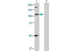 Western Blot analysis of PPFIBP2 expression in transfected 293T cell line by PPFIBP2 MaxPab polyclonal antibody. (PPFIBP2 antibody  (AA 1-876))