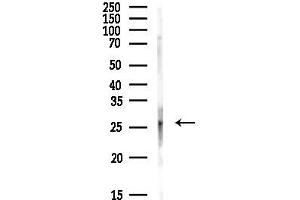 anti-BCL2/adenovirus E1B 19kDa Interacting Protein 3 (BNIP3) (C-Term) antibody