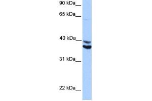 WB Suggested Anti-MDFIC Antibody Titration:  0. (MDFIC antibody  (Middle Region))