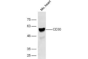 Lane 1: Mouse heart lysates probed with Rabbit Anti-CD30 Polyclonal Antibody, Unconjugated (ABIN1385704) at 1:300 overnight at 4˚C. (TNFRSF8 antibody  (AA 51-150))