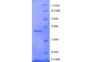 Agouti Related Protein Homolog (Mouse) (AGRP) (AA 83-132), (partial) protein (GST tag) (AGRP Protein (AA 83-132, partial) (GST tag))