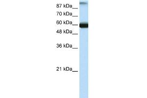 WB Suggested Anti-GTF3C5 Antibody Titration:  0.
