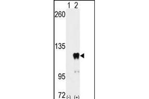 PUM2 抗体  (AA 159-189)