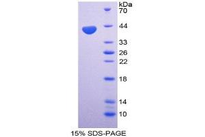 SDS-PAGE (SDS) image for Chemokine (C-C Motif) Ligand 4 (CCL4) (AA 24-92) protein (His tag,GST tag) (ABIN1980650)