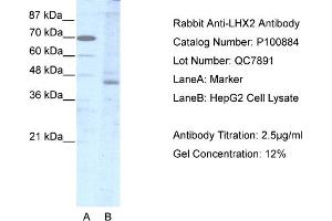 WB Suggested Anti-LHX2  Antibody Titration: 2. (LHX2 antibody  (Middle Region))