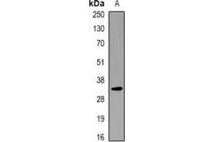 Western blot analysis of KCNE1 expression in RAW264. (KCNE1 antibody)