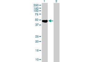 Western Blot analysis of OSMR expression in transfected 293T cell line by OSMR MaxPab polyclonal antibody.