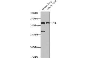 Western blot analysis of extracts of various cell lines, using PPL Rabbit pAb (ABIN6128531, ABIN6146035, ABIN6146037 and ABIN6218272) at 1:1000 dilution.