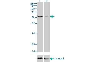 Western blot analysis of TOE1 over-expressed 293 cell line, cotransfected with TOE1 Validated Chimera RNAi (Lane 2) or non-transfected control (Lane 1).