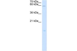 Western Blotting (WB) image for anti-Retinoic Acid Receptor Responder (Tazarotene Induced) 3 (RARRES3) antibody (ABIN2462984) (RARRES3 antibody)